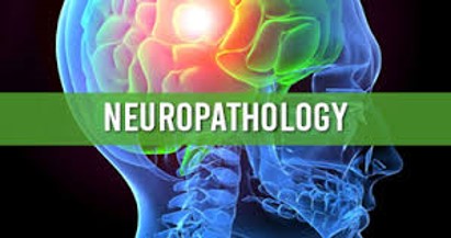 Neuropathy image of human skull